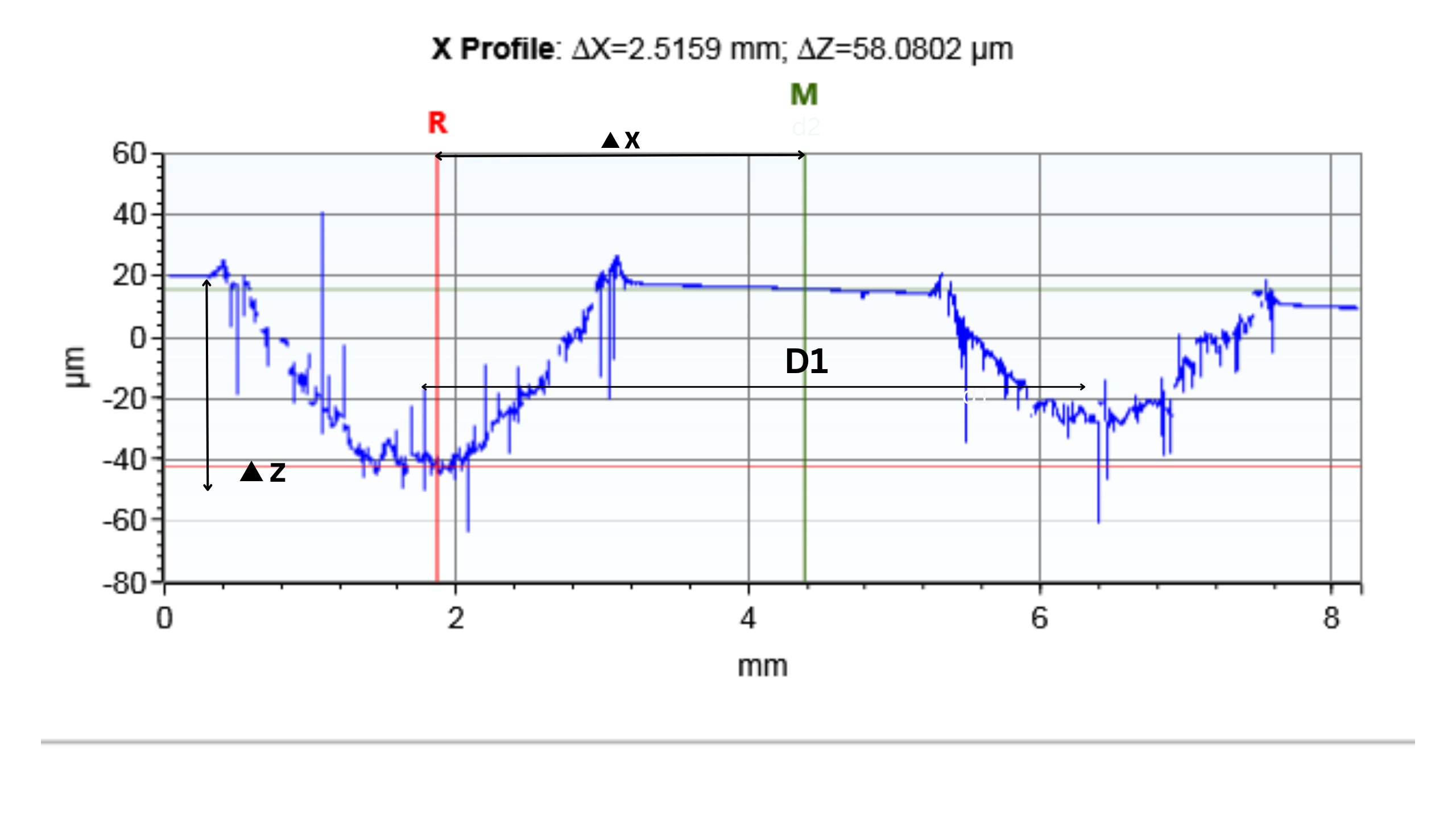 X Profile